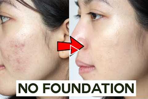 How to Cover Acne & Blemishes WITHOUT Foundation  • easy & non cakey