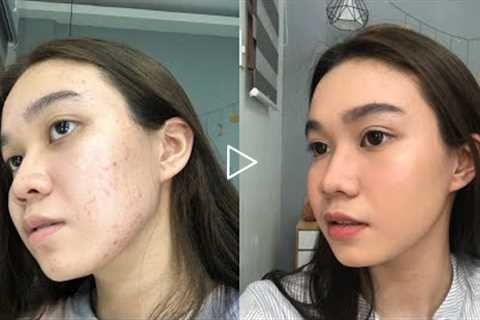 How To Cover Acne Marks/Pimples with No Foundation | Andy Buela (Philippines)